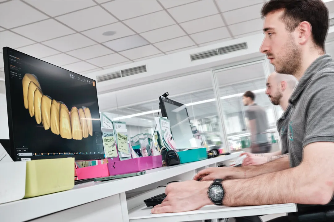 Digital CAD-CAM design of a dental arch